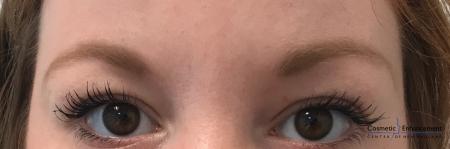 Microblading: Patient 4 - Before Image 1