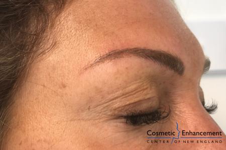 Microblading: Patient 6 - After Image 1