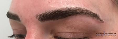 Microblading: Patient 1 - After Image 3