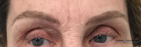 Microblading: Patient 5 - After Image 1
