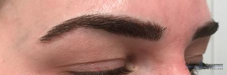 Microblading: Patient 1 - After Image 2