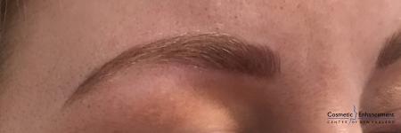 Microblading: Patient 4 - After Image 2