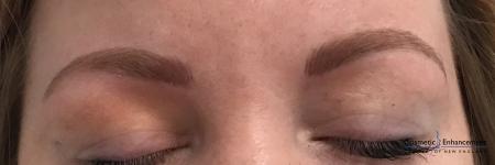 Microblading: Patient 4 - After Image 1