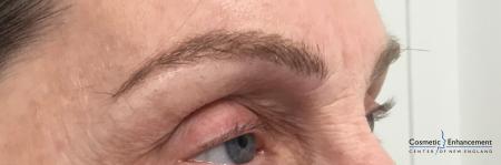 Microblading: Patient 5 - After Image 2
