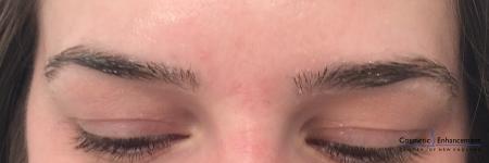 Microblading: Patient 1 - Before Image 1