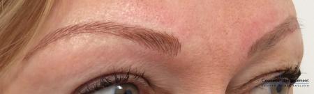 Microblading: Patient 3 - After Image 1