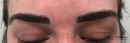 Microblading: Patient 1 - After Image 1