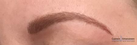 Microblading: Patient 4 - After Image 3