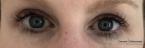 Lash Lift And Tint: Patient 3 - After 