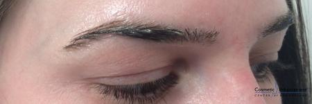 Microblading: Patient 1 - Before Image 2