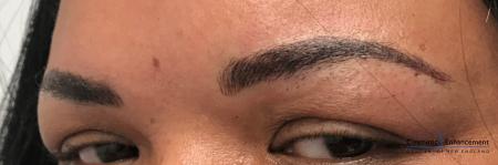 Microblading: Patient 2 - After Image 2