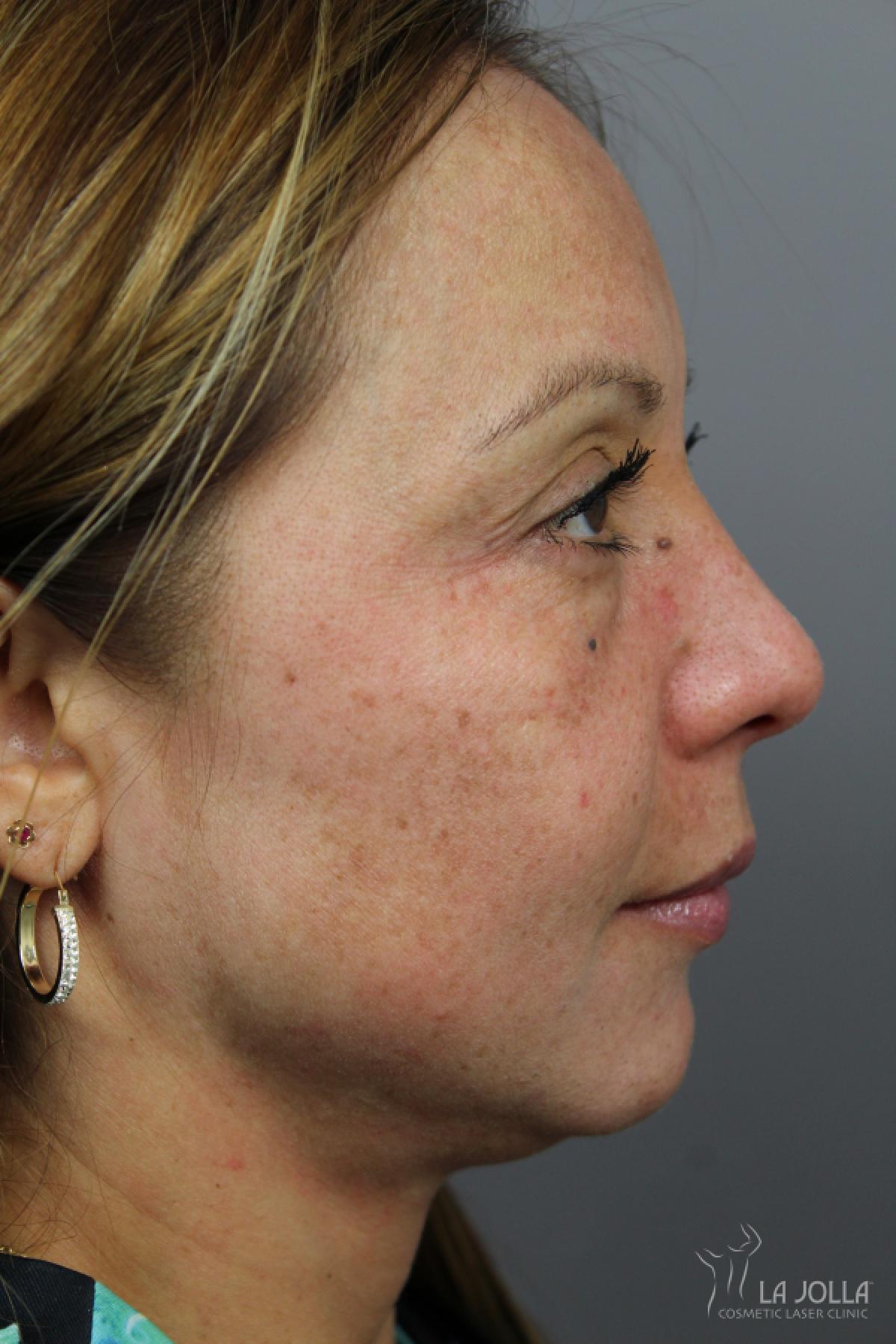 Skin Care Products: Patient 1 - After  