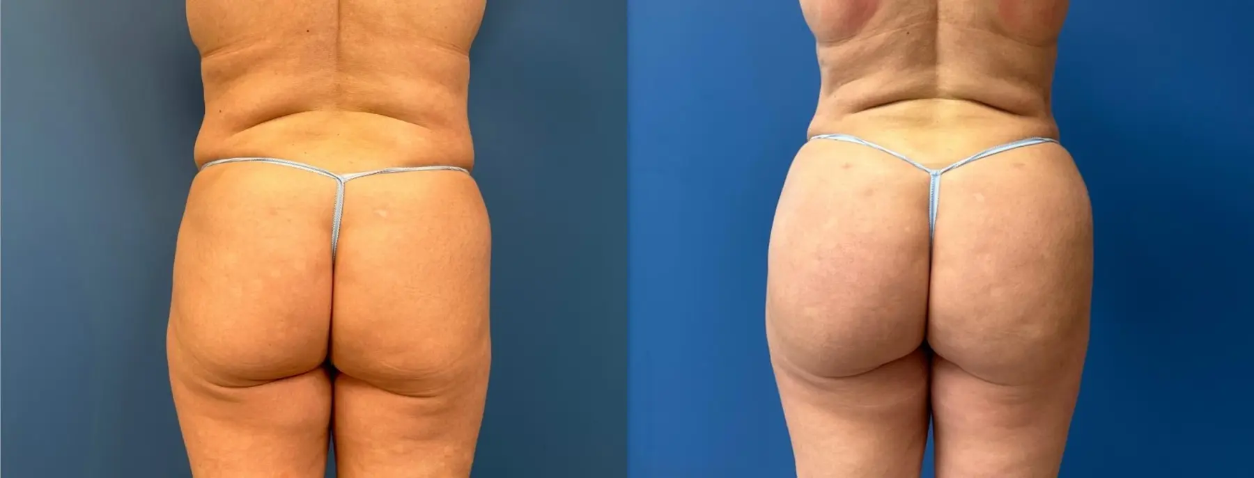 safe bbl - Before and After  