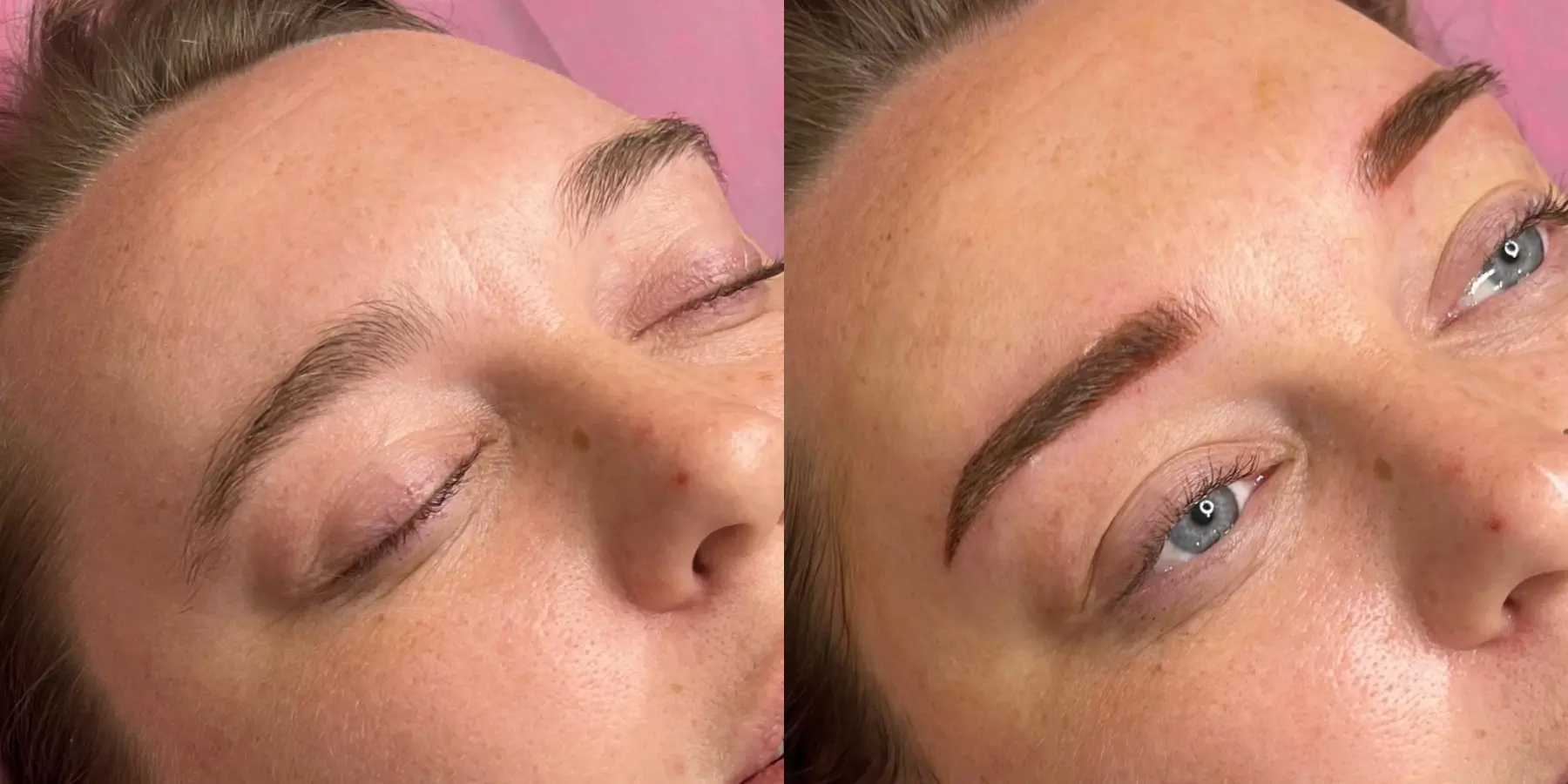 Permanent Makeup: Patient 2 - Before and After