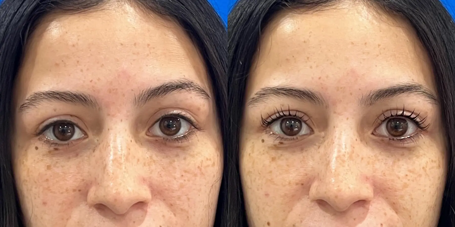 Permanent Makeup: Patient 1 - Before and After 2