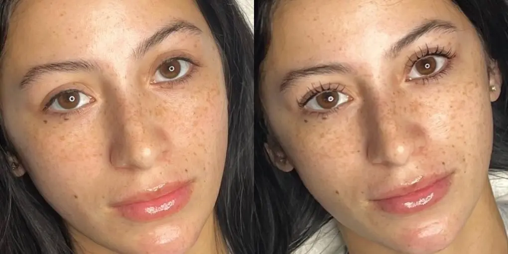 Permanent Makeup: Patient 1 - Before and After