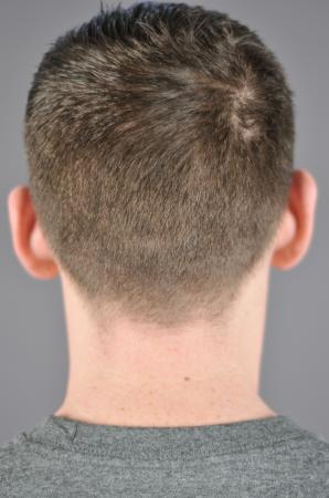 Before Image 2