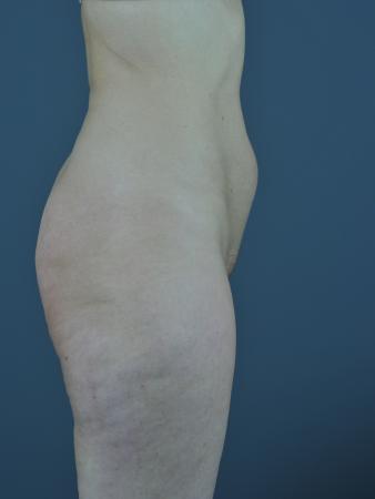 Before Image 3