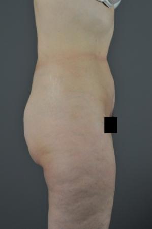 After Image 3