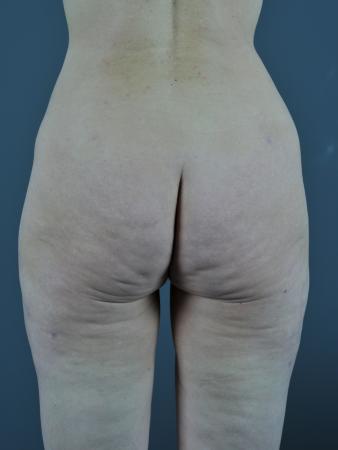 After Image 4