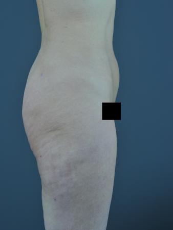 After Image 3