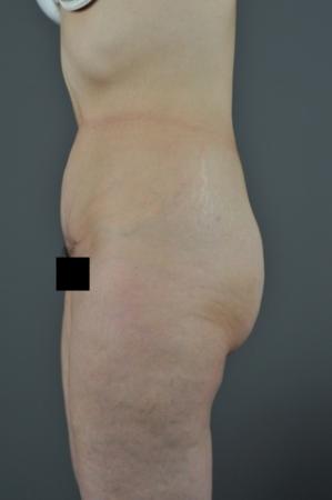 After Image 2
