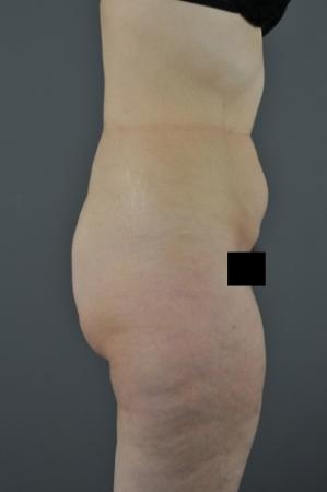 Before Image 3