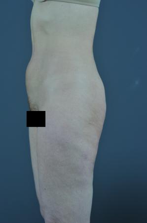 After Image 2