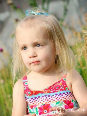 Denver Cleft Lip and Palate Repair 4776 - After Image 2